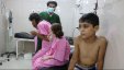 منظمة حظر الأسلحة الكيميائية تحقق في هجوم على حلب