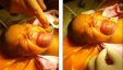 بالصور: طفل يصدم الأطباء بعد الولادة.. ما أصيب به نادر!