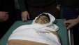 استشهاد طفل من العروب متأثر باصابته برصاص الاحتلال