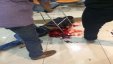 بالصور والفيديو : قتيل واصابات في عملية بئر السبع 