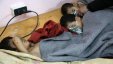 اصابة العشرات بحالات اختناق في الغوطة الشرقية